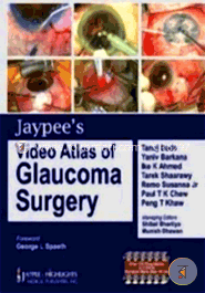 Jaypee's Video Atlas of Glaucoma Surgery image