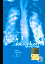 Clinical Tuberculosis image