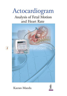 Actocardiogram: Analysis of Fetal Motion and Heart Rate image