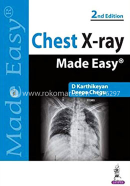 Chest X-Ray Made Easy image