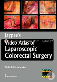 Jaypee's Video Atlas of Laparoscopic Colorectal Surgery image