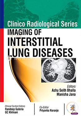 Clinico Radiological Series: Imaging of Interstitial Lung Diseases image