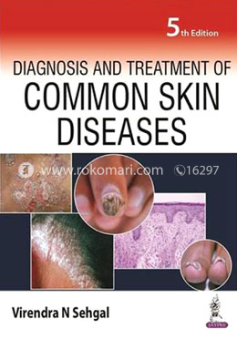 Diagnosis and Treatment of Common Skin Diseases image