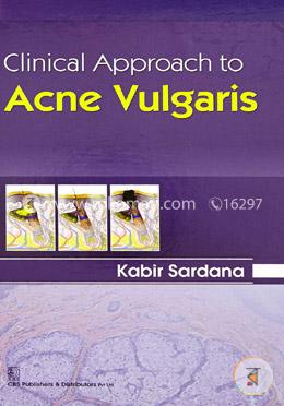 Clinical Approach to Acne Vulgaris