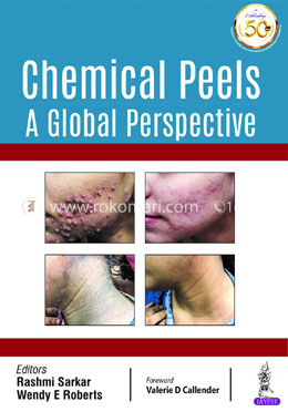 Chemical Peels: A Global Perspective image