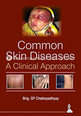 Common Skin Diseases : A Clinical Approach