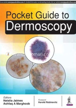 Pocket Guide to Dermoscopy image