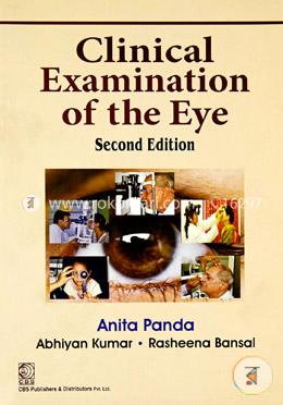 Clinical examination of the Eye image