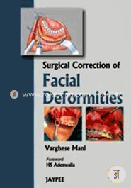 Surgical Correction of Facial Deformities (Paperback) image