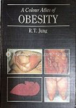 A Colour Atlas of Obesity image