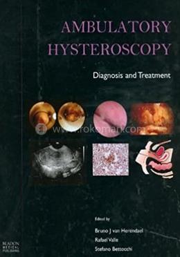 Ambulatory Hysteroscopy image