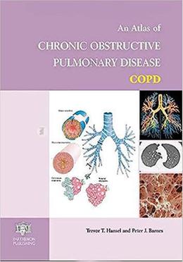 An Atlas Of Chronic Obstructive Pulmonary Disease image