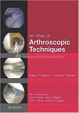 An Atlas of Arthroscopic Techniques image