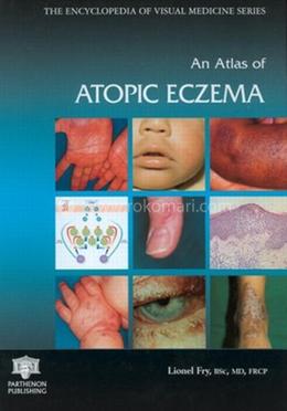An Atlas of Atopic Eczema image