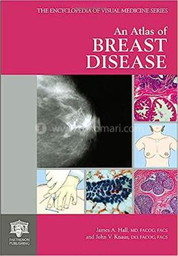 An Atlas of Breast Disease image