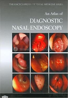 An Atlas of Diagnostic Nasal Endoscopy image