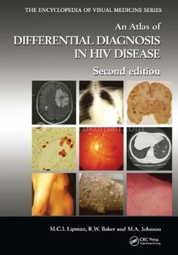 An Atlas of Differential Diagnosis in HIV Disease image