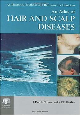 An Atlas of Hair and Scalp Diseases image