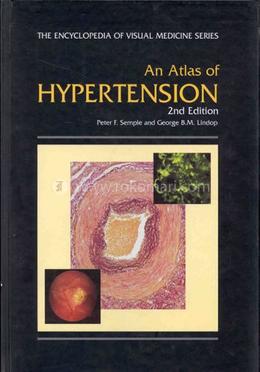 An Atlas of Hypertension image