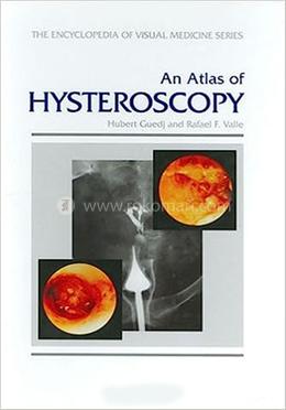 An Atlas of Hysteroscopy image