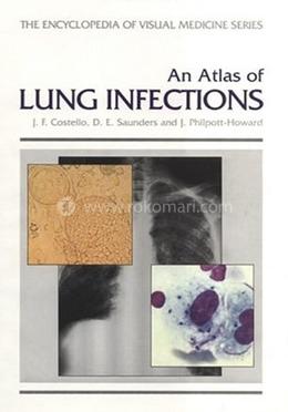 An Atlas of Lung Infections image