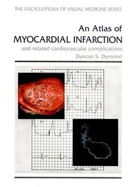 An Atlas of Myocardial Infarction image