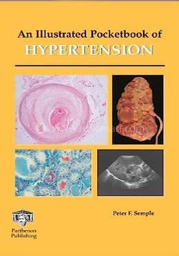 An Illustrated Pocketbook of Hypertension image