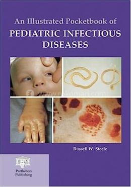 An Illustrated Pocketbook of Pediatric Infectious Diseases image