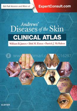 Andrews' Diseases of the Skin Clinical Atlas image