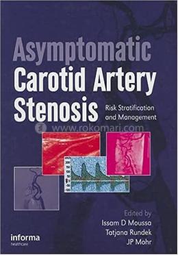Asymptomatic Carotid Artery Stenosis image