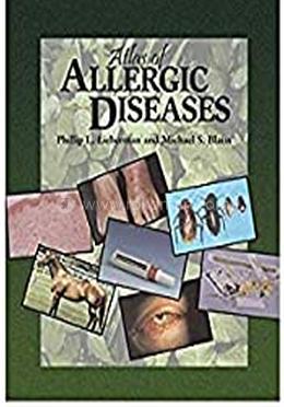 Atlas of Allergic Diseases image