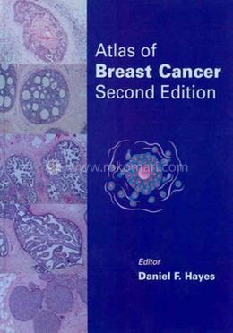 Atlas of Breast Cancer image