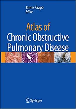 Atlas of Chronic Obstructive Pulmonary Disease image