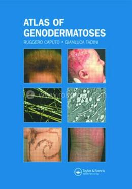 Atlas of Genodermatoses image