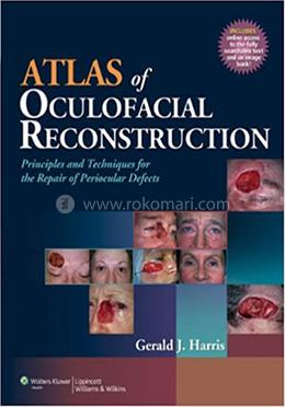 Atlas of Oculofacial Reconstruction image
