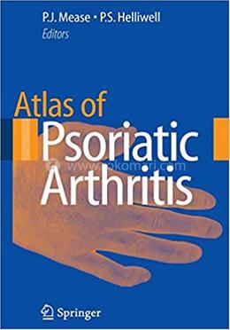 Atlas of Psoriatic Arthritis image