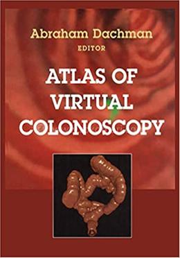 Atlas of Virtual Colonoscopy image