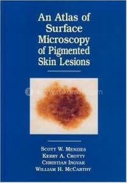 Atlas of the Surface Microscopy of Pigmented Skin Tumour image