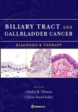 Biliary Tract and Gallbladder Cancer image