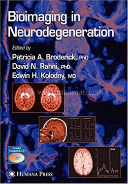 Bioimaging in Neurodegeneration image