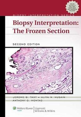 Biopsy Interpretation - The Frozen Section image