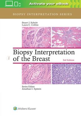 Biopsy Interpretation of the Breast image