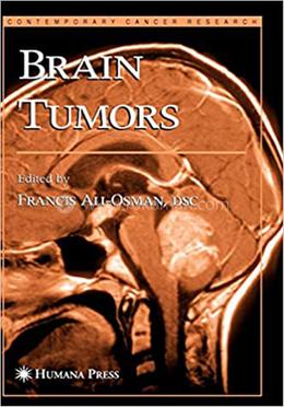 Brain Tumors (Contemporary Cancer Research) image