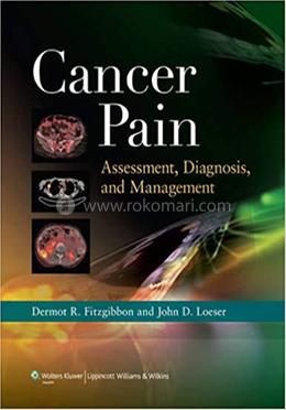 Cancer Pain: Assessment, Diagnosis, and Management image