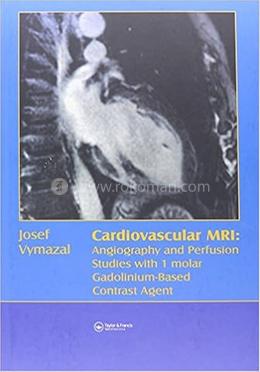 Cardiovascular MRI image