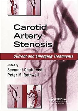 Carotid Artery Stenosis image