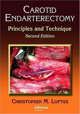 Carotid Endarterectomy image