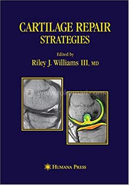 Cartilage Repair Strategies image