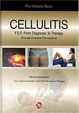 Cellulitis image