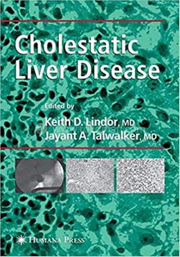 Cholestatic Liver Disease image